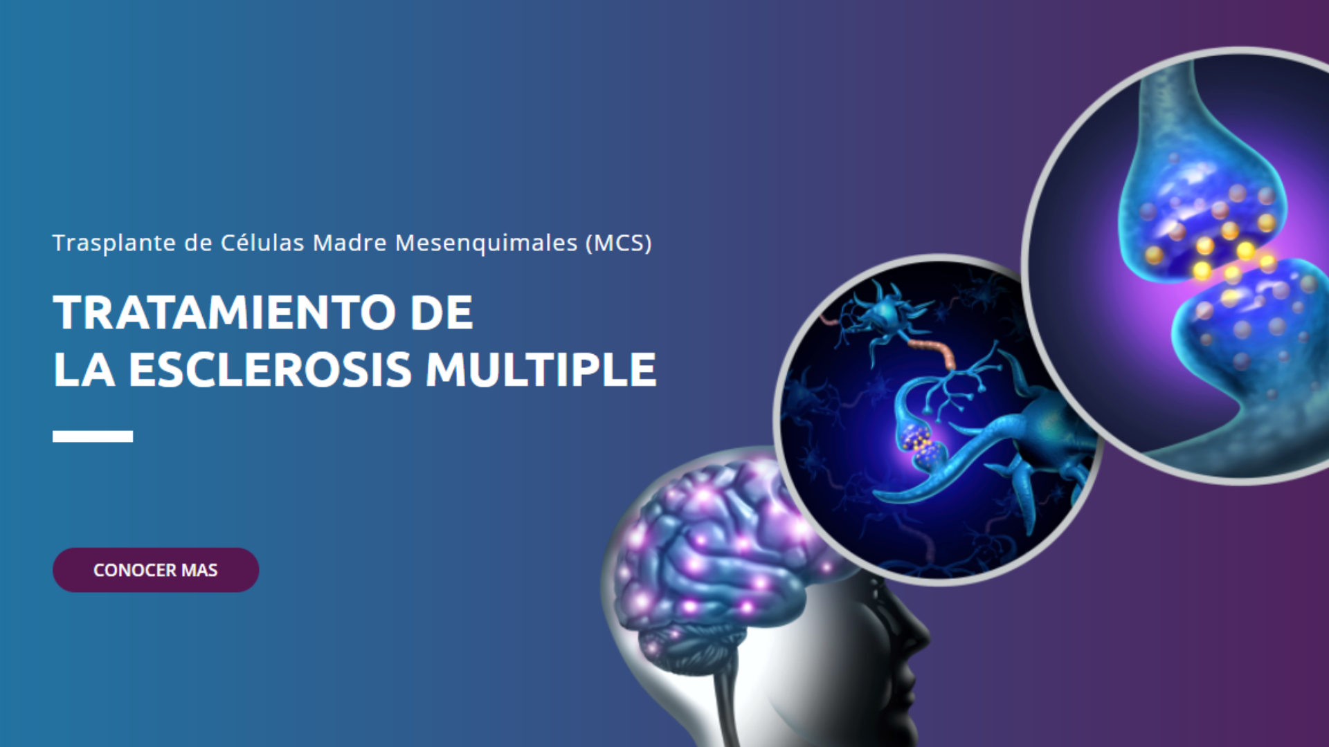 INMUNOCELL | Esclerosis Múltiple | Medicina Regenerativa