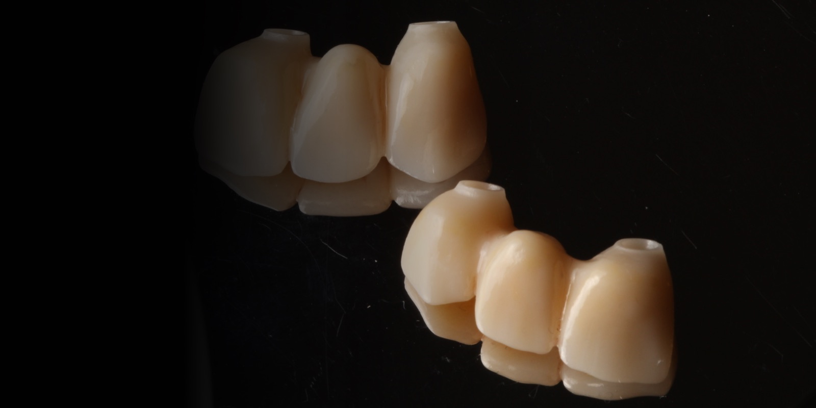 Coronas de porcelana terminadas en laboratorio dental